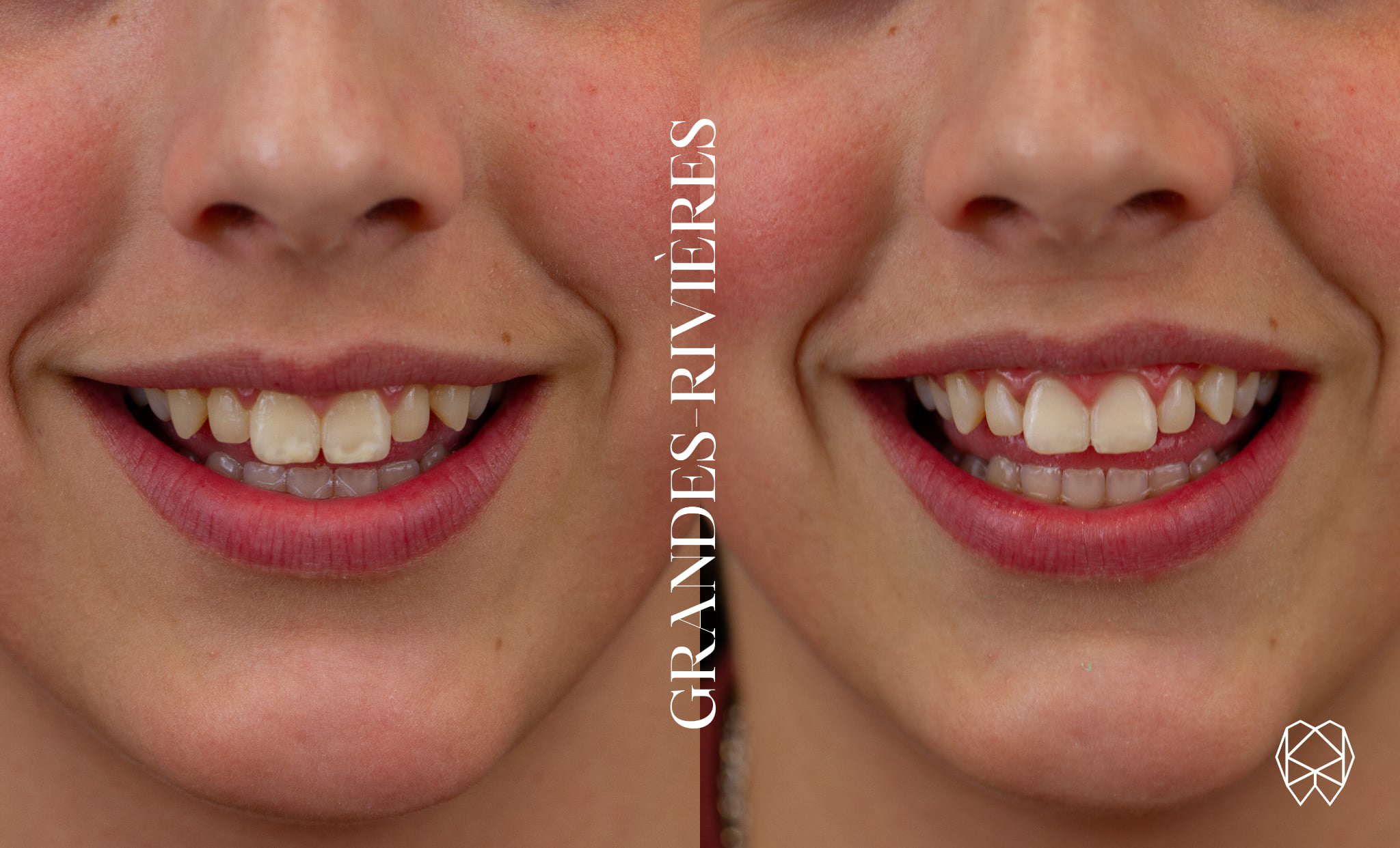 51A4C865-8D6E-40D2-8612-0ED54B7B965A