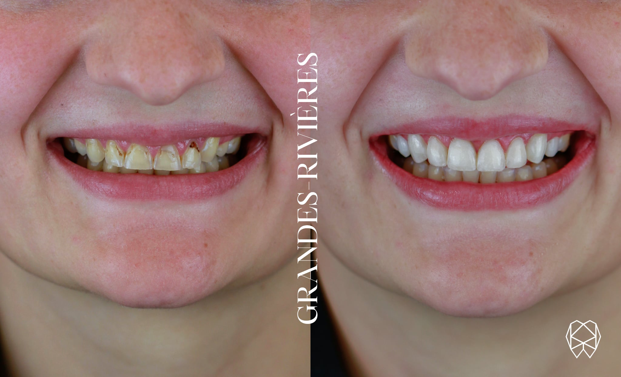 CE2E0D0F-B46E-480C-A533-6F28A43993D5